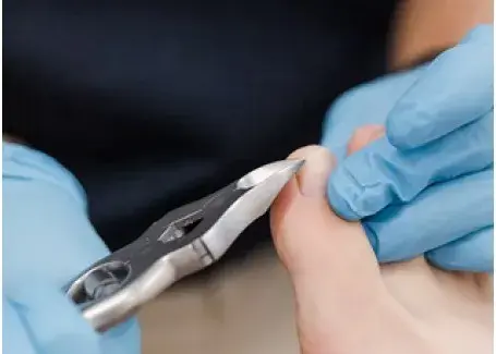 podiatry-instruments-431742-1781595530